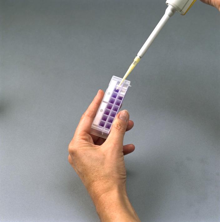 Delvotest T 5 Plates (Suitable for use in Milk intake labs only; detects antibiotic residues levels similar to SP NT, while also detecting Tetracyclines to MRL)